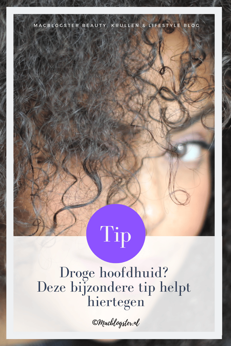 Droge Hoofdhuid Deze Bijzondere Tip Helpt Hiertegen Macblogster